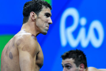 michael-phelps-Cupping-Therapy