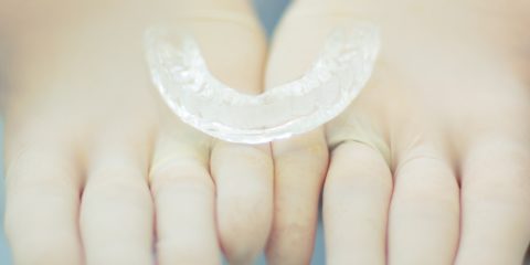 Invisalign_Braces